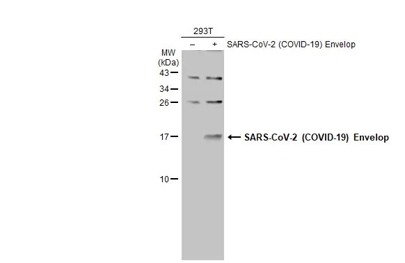 Non-transfected (–) and transfected (+) 293T whole cell extracts (30 μg) were separated by 15% SDS-PAGE, and the membrane was blotted with SARS-CoV-2 (COVID-19) Envelop antibody (GTX136046) diluted at 1:1000. The HRP-conjugated anti-rabbit IgG antibody (GTX213110-01) was used to detect the primary antibody.