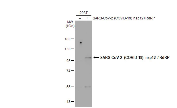 SARS-CoV-2 (COVID-19) nsp12 / RdRP antibody