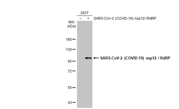 Non-transfected (–) and transfected (+) 293T whole cell extracts (30 μg) were separated by 7.5% SDS-PAGE, and the membrane was blotted with SARS-CoV-2 (COVID-19) nsp12 / RdRP antibody (GTX136050) diluted at 1:5000. The HRP-conjugated anti-rabbit IgG antibody (GTX213110-01) was used to detect the primary antibody.