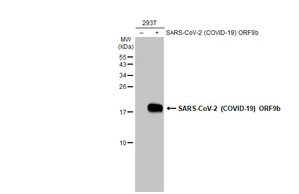 SARS-CoV-2 (COVID-19) ORF9b antibody