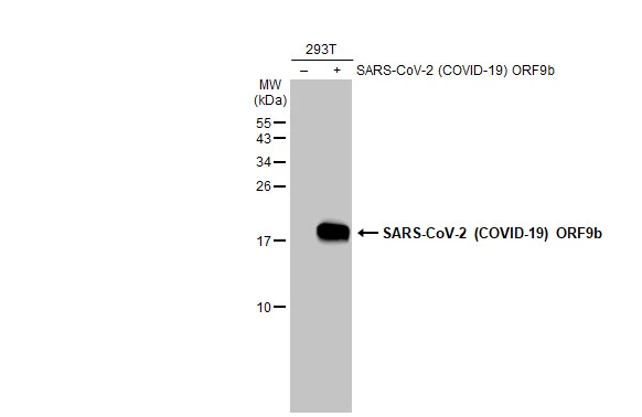 Non-transfected (–) and transfected (+) 293T whole cell extracts (30 μg) were separated by 15% SDS-PAGE, and the membrane was blotted with SARS-CoV-2 (COVID-19) ORF9b antibody (GTX136053) diluted at 1:5000. The HRP-conjugated anti-rabbit IgG antibody (GTX213110-01) was used to detect the primary antibody.