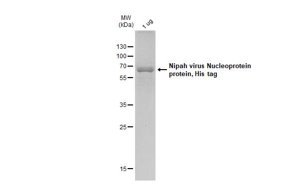 Nipah virus Nucleoprotein protein, His tag protein were analyzed using SDS-PAGE and stained with coomassie blue and captured by monochrome camera.