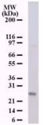 WB analysis of 293 cell lysate using GTX13666 NKIRAS1 antibody [184C278]. Dilution : 0.5 ug/ml