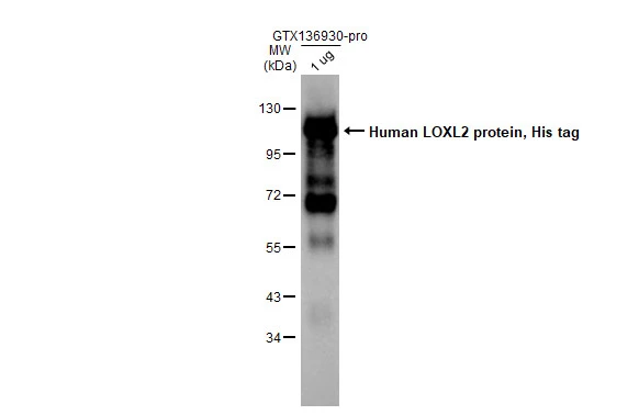 Human LOXL2 protein, His tag