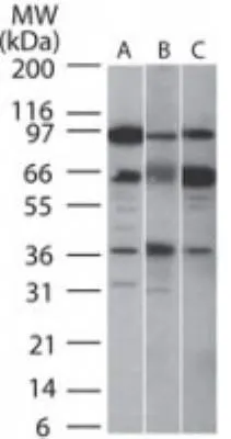 WB analysis of (A) human, (B) mouse, and (C) rat intestine tissue lysate using GTX13697 SIRT5 antibody. Dilution : 2 microg/ml WB analysis of (A) human, (B) mouse, and (C) rat intestine tissue lysate using GTX13697 SIRT5 antibody. Dilution : 2 microg/ml