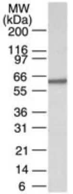 WB analysis of HeLa cell lysate using GTX13707 CARM1 antibody. Dilution : 5 ug/ml