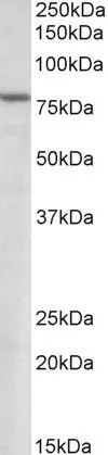 WB analysis of human heart lysate using GTX13712 SETDB2 antibody,N-term. Dilution : 1.5ug/ml Loading : 35ug protein in RIPA buffer