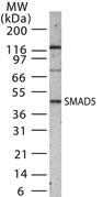 Western blot analysis of Smad5 in 30 ug of Saos-2 cell lysate using anti-Smad5 antibody (GTX13724) at 1:1000 dilution.