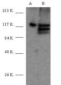 Western blot analysis of human SIRTI expression in HeLa (A) and HeLa+CoC12 (B) whole cell lysates
