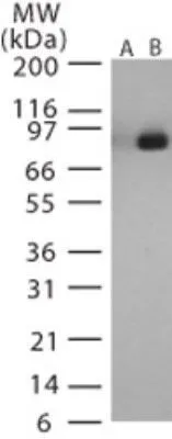 WB analysis of recombinant anthrax LF protein using GTX13807 Bacillus anthracis Lethal Factor antibody. Lane 1 : pre-bleed Lane 2 : primary antibody WB analysis of recombinant anthrax LF protein using GTX13807 Bacillus anthracis Lethal Factor antibody. Lane 1 : pre-bleed Lane 2 : primary antibody