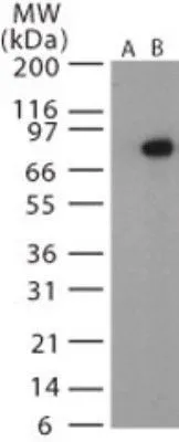 WB analysis of recombinant anthrax PA protein using GTX13809 Bacillus anthracis protective antigen antibody. Lane 1 : pre-bleed Lane 2 : primary antibody Dilution : 1:1000 WB analysis of recombinant anthrax PA protein using GTX13809 Bacillus anthracis protective antigen antibody. Lane 1 : pre-bleed Lane 2 : primary antibody Dilution : 1:1000