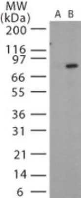 WB analysis of recombinant anthrax PA protein using GTX13809 Bacillus anthracis protective antigen antibody. Lane 1 : pre-bleed Lane 2 : primary antibody