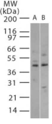 WB analysis of (A) human brain and (B) mouse brain cell lysate using GTX13864 p38 beta antibody. Loading : 15microg WB analysis of (A) human brain and (B) mouse brain cell lysate using GTX13864 p38 beta antibody. Loading : 15microg