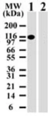 WB analysis of HEK293 overexpressing mouse DNMT3A (Lanes 1) or mouse DNMT3B (Lane 2) cell lysate using GTX13887 DNMT3A antibody [64B814.1]. Dilution : 2 microg/ml
