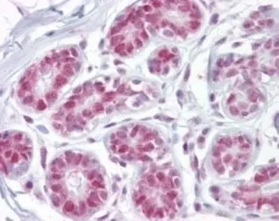 IHC-P analysis of human breast tissue using GTX13902 APE1 antibody. Dilution : 10 microg/ml