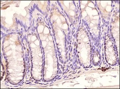 IHC-P analysis of mouse colon tissue using GTX13915 TLR3 antibody [40C1285.6]. Dilution : 1:500