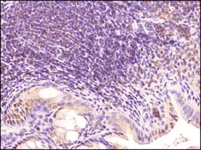 IHC-P analysis of mouse intestine tissue using GTX13915 TLR3 antibody [40C1285.6]. Dilution : 1:500