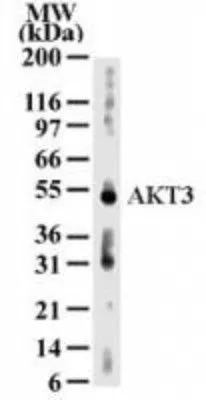 WB analysis of human kidney tissue lysate using GTX13919 AKT3 antibody [66C1247]. Dilution : 2 microg/ml Loading : 30microg