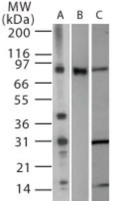 WB analysis of (A)RAW264.7 (B) overexpressing mouse TLR2, and (C) Ramos cell lysate using GTX13930 TLR2 antibody. Dilution : 1 microg/ml WB analysis of (A)RAW264.7 (B) overexpressing mouse TLR2, and (C) Ramos cell lysate using GTX13930 TLR2 antibody. Dilution : 1 microg/ml