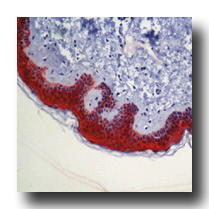 IHC-P analysis of human skin tissue using GTX14116 14-3-3 sigma antibody [1.N.6] (Azide free).