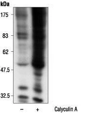 WB analysis of calyculin A treated or untreated A431 cells using GTX14126 14-3-3 (phospho Ser) antibody [3i2(4E2)].