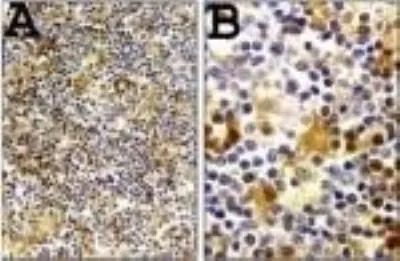 IHC-P analysis of human reactive lymph node tissue using GTX14368 Caspase 1 antibody. B is a higher magnification of A. Staining in macrophages is observed.