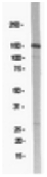 WB analysis of rat brain microsomal preparation using GTX14400 NMDAR2B antibody. Dilution : 1microg/ml WB analysis of rat brain microsomal preparation using GTX14400 NMDAR2B antibody. Dilution : 1microg/ml