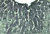 Immunohistochemistry of livers treated with diethylnitrosamine (200 mg/kg) andstained with GTX14459 diluted 1/100.After treatment livers were removed and rapidly processed 10 hr later, at peak polymer induction. Immunohistochemistry of livers treated with diethylnitrosamine (200 mg/kg) andstained with GTX14459 diluted 1/100.After treatment livers were removed and rapidly processed 10 hr later, at peak polymer induction.