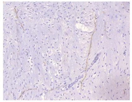 IHC-P analysis of human ovarian medulla tissue using GTX14607 PDE4A antibody. Dilution : 1:15000