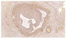 IHC-P analysis of human ovarian medulla tissue using GTX14608 PDE4C antibody. Dilution : 1:3000 IHC-P analysis of human ovarian medulla tissue using GTX14608 PDE4C antibody. Dilution : 1:3000