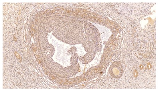 IHC analysis of human ovarian medulla tissue using GTX14608 PDE4C antibody.<br>Dilution : 1:3000
