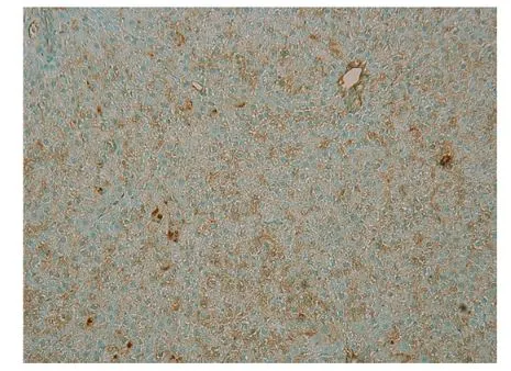 ICC/IF analysis of SH-SY5Y cells using GTX14611 PDE4B antibody. Dilution : 1:250 ICC/IF analysis of SH-SY5Y cells using GTX14611 PDE4B antibody. Dilution : 1:250