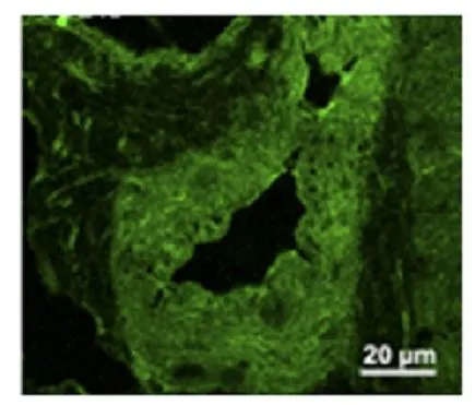IHC-Fr analysis of abdominal skeletal muscle tissue using GTX14613 PDE4D antibody. Dilution : 1:200 IHC-Fr analysis of abdominal skeletal muscle tissue using GTX14613 PDE4D antibody. Dilution : 1:200