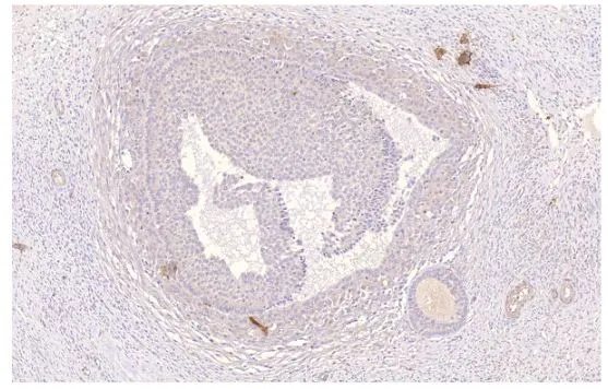 IHC-P analysis of human ovarian medulla tissue using GTX14613 PDE4D antibody. Dilution : 1:50