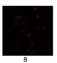 ICC/IF analysis of PDE4B3 transfected COS1 cells using GTX14615 PDE4B3 antibody. ICC/IF analysis of PDE4B3 transfected COS1 cells using GTX14615 PDE4B3 antibody.