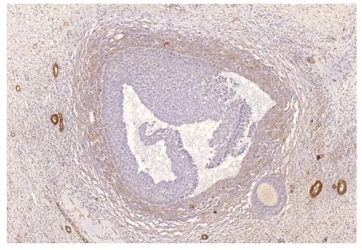 IHC analysis of human ovarian medulla tissue using GTX14618 PDE8A antibody. Dilution : 1:200 IHC analysis of human ovarian medulla tissue using GTX14618 PDE8A antibody. Dilution : 1:200