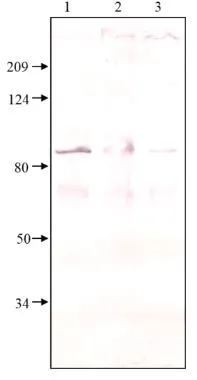 WB analysis of various samples using GTX14619 PDE8A antibody. Lane 1: SDS-solubilized PDE8 cell cytosol Lane 2: SDS-solubilized treated-PDE8 cell cytosol Lane 3: SDS-solubilized PDE8 cell membrane Dilution : 1:500