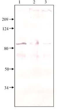 WB analysis of non-reduced and heated sample lysates using GTX14619 PDE8A antibody. Lane 1 : SDS-solubilized PDE8 cytosol fraction Lane 2 : SDS-solubilized treated-PDE8 cytosol fraction Lane 3 : SDS-solubilized PDE8 cell membrane fraction WB analysis of non-reduced and heated sample lysates using GTX14619 PDE8A antibody. Lane 1 : SDS-solubilized PDE8 cytosol fraction Lane 2 : SDS-solubilized treated-PDE8 cytosol fraction Lane 3 : SDS-solubilized PDE8 cell membrane fraction