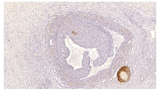 Western blot of rat testis and heart homogenate using GTX14621 (1:500 dilution)