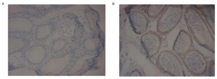 Western using GTX14622 and various rat brain regions. GTX14622 antibody 1:500 diluted.