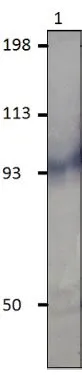 WB analysis of PDE11A recombinant protein using GTX14623 PDE11A antibody. Dilution : 1:250