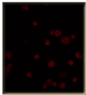 Western blot of human recombinant GFP-PDE5A with PDE5A (GTX14672) and Phospho-PDE5A antibodies.