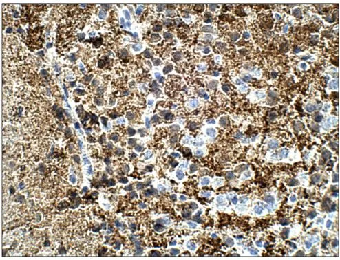IHC-P analysis of mouse brain tissue using GTX14689 Calretinin antibody. Dilution : 1:100