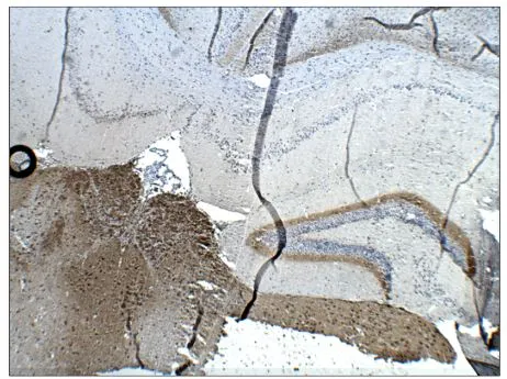 IHC-P analysis of mouse brain tissue using GTX14689 Calretinin antibody. Dilution : 1:100