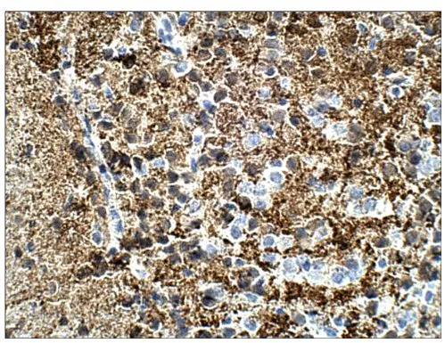 IHC-P analysis of mouse brain tissue using GTX14689 Calretinin antibody. Dilution : 1:100