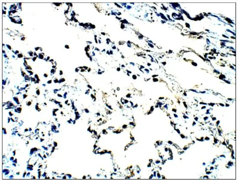 Baboon Lung- MUC1. Primary Antibody at 1:100 dilution in IHC Blocking Buffer,DAB (brown) staining and Hematoxylin QS (blue) counterstain,40x magnification on Leica DM4000 microscope. FFPE sertion.