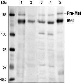 WB analysis of various samples using GTX14700 c-Met antibody [3i20(25H2)].<br>Lane 1 : mIMCD3<br>Lane 2 : Vero<br>Lane 3 : 293 (HGF stimulated)<br>Lane 4 : 293 (starved)<br>Lane 5 : C6
