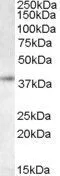 WB analysis of K562 lysate using GTX14751 RNF2 antibody, C-term. Dilution : 0.5microg/ml Loading : 35microg protein in RIPA buffer WB analysis of K562 lysate using GTX14751 RNF2 antibody, C-term. Dilution : 0.5microg/ml Loading : 35microg protein in RIPA buffer
