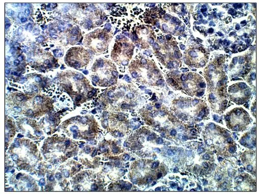 IHC-P analysis of mouse kidney tissue using GTX14782 ADCY7 antibody. Dilution : 1:50 IHC-P analysis of mouse kidney tissue using GTX14782 ADCY7 antibody. Dilution : 1:50