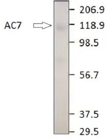 WB analysis of ADCY7 recombinant protein using GTX14782 ADCY7 antibody. Dilution : 1:1,000